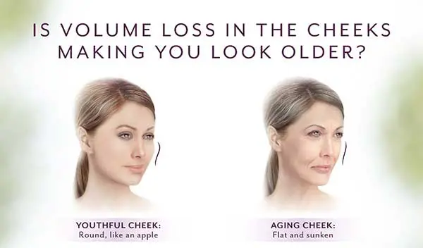 Is volume loss in the cheeks making you look older? Try Juvéderm Voluma injections to lift your cheeks.