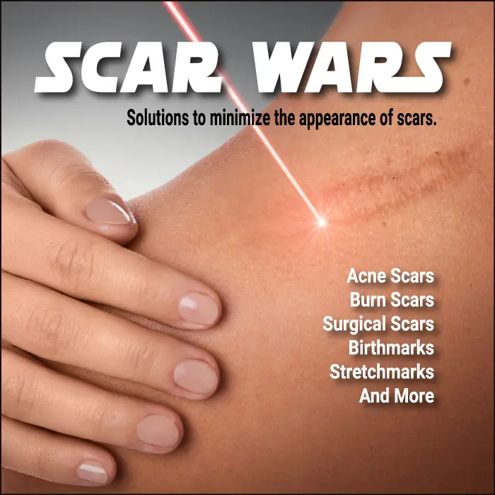 SCAR: Solutions, Correction, Aesthetic, Results