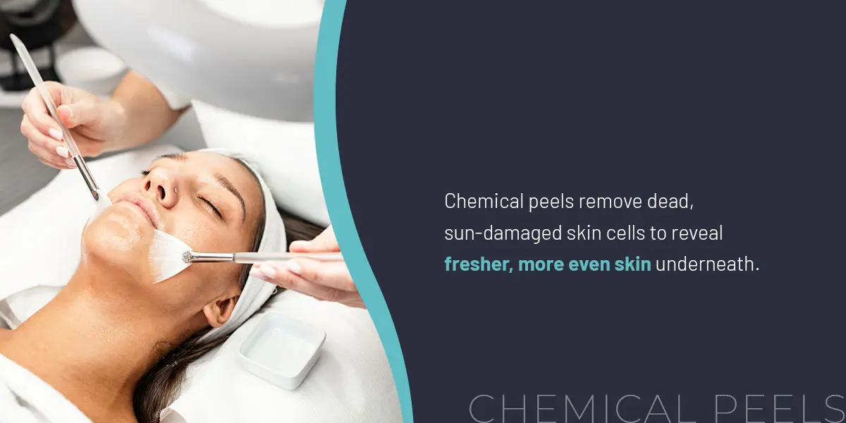 02-Chemical-peels | Contour Dermatology Woman lying with eyes closed as a practitioner applies a facial peel with brushes during a spa treatment