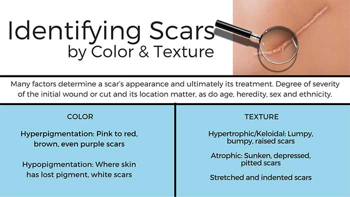 How to identify a scar by color and texture.