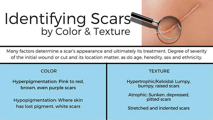 How Makeup Affects the Scar Healing Process and How to Reduce Scar Not