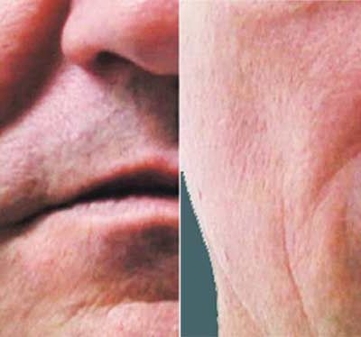 Sublime Before and After