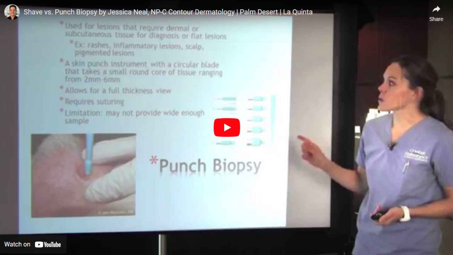 Shave Vs Punch Biopsy By Jessica Neal NP C   10 14 2014 Shave Vs Punch Biopsy By Jessica Neal 