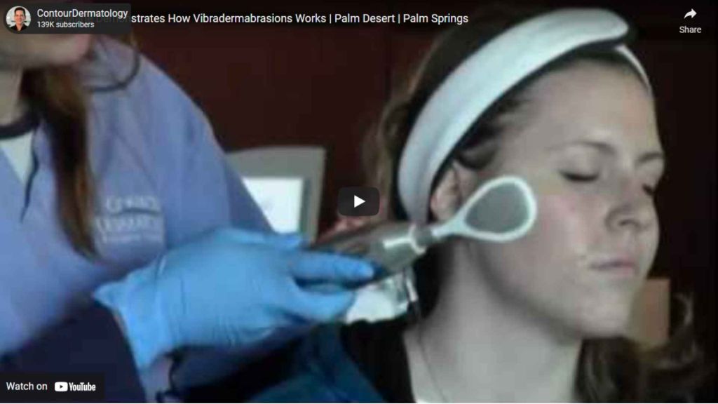 Anne Marie Demonstrates How Vibradermabrasions Works