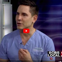 CBS Local 2 Interview with Dr. Timothy Jochen, Winter Skin Care Tips
