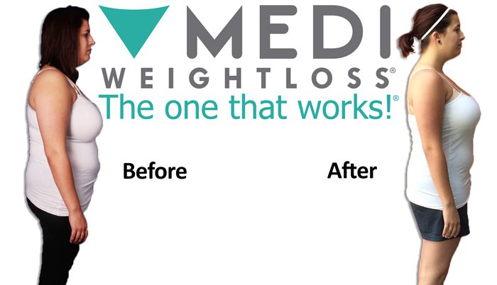 Medi-Weight Loss