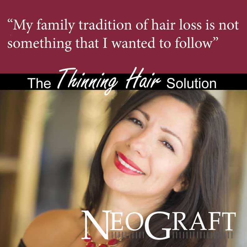 Stop that family tradition of hair loss, today, 760-423-4000.
