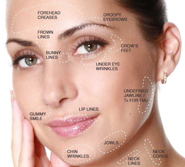 Restore Your Youthful Look with Botox