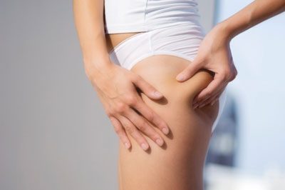 Cellulite, Causes & Solutions at Contour Dermatology