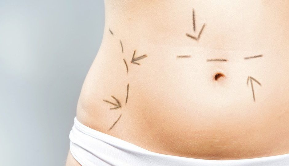 Top reasons to get contoured by Dr. Jochen