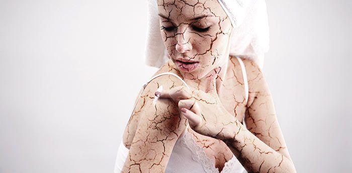 Tips for Relieving Dry Skin