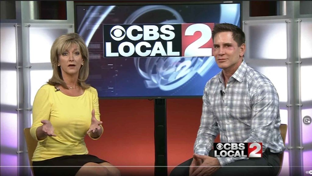 Dr. Timothy Jochen, Board Certified Dermatologist with Contour Dermatology & Cosmetic Surgery Center talks with Jenifer Daniels of CBS about scar treatment solutions including many promising treatments for acne scars, old scars and more.