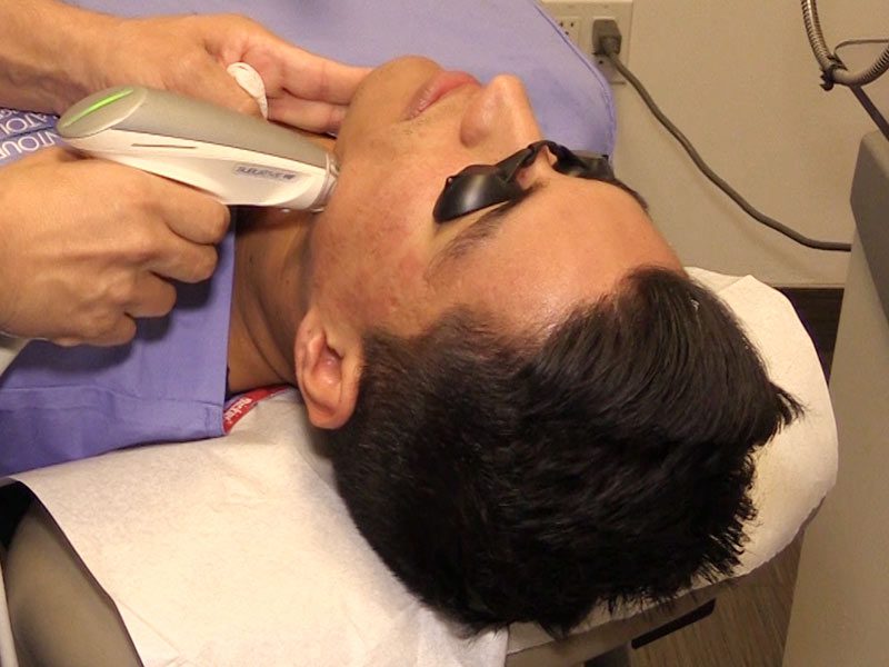 Laser Services for Men Contour Dermatology