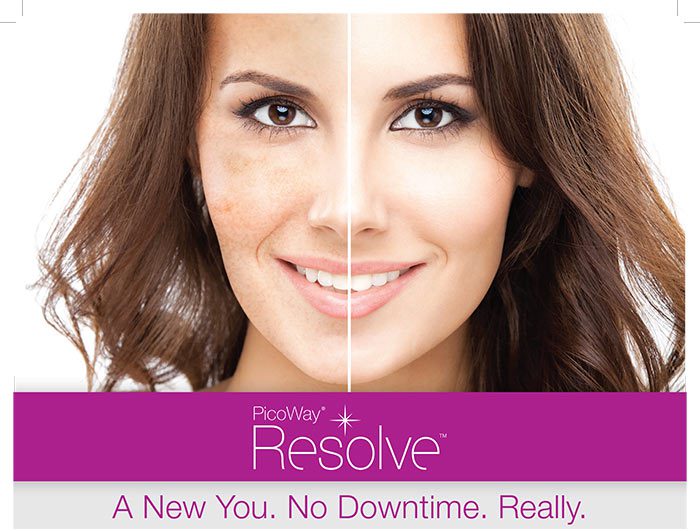 Brown spots and areas of uneven pigmentation become things of the past with PicoWay.