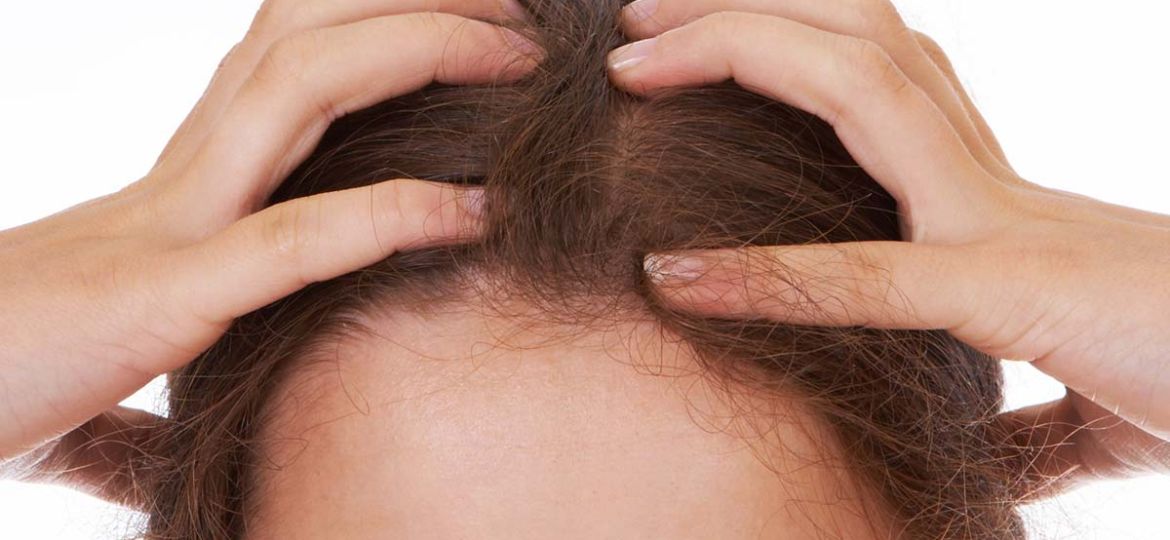 As a woman suffering from hair loss you may feel like the minority forced to suffer in silence, but actually, nearly half of Americans dealing with hair loss are woman.