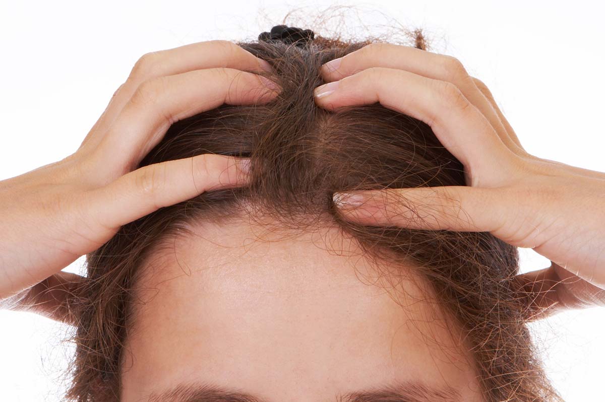 As a woman suffering from hair loss you may feel like the minority forced to suffer in silence, but actually, nearly half of Americans dealing with hair loss are woman.