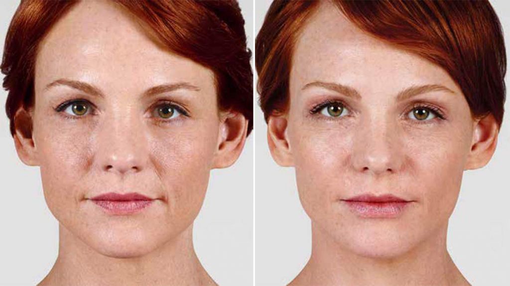 contour dermatology and cosmetics
