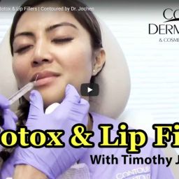 Contour Nurse Practitioner Xarlyn gets her first Lip Filler and Botox from Top Doctor Timothy Jochen.