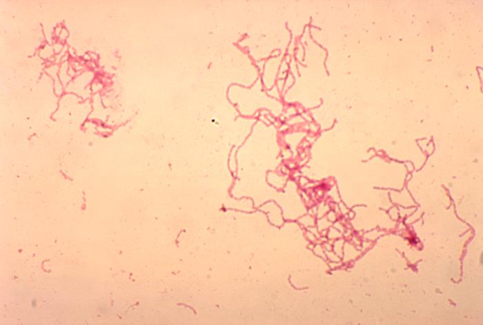 Chancroid is a sexually transmitted disease caused by the organism Haemophilus ducreyi - a bacteria.
