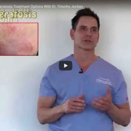 05-14-2018- Actinic Keratosis Treatment Options | Contour Dermatology
