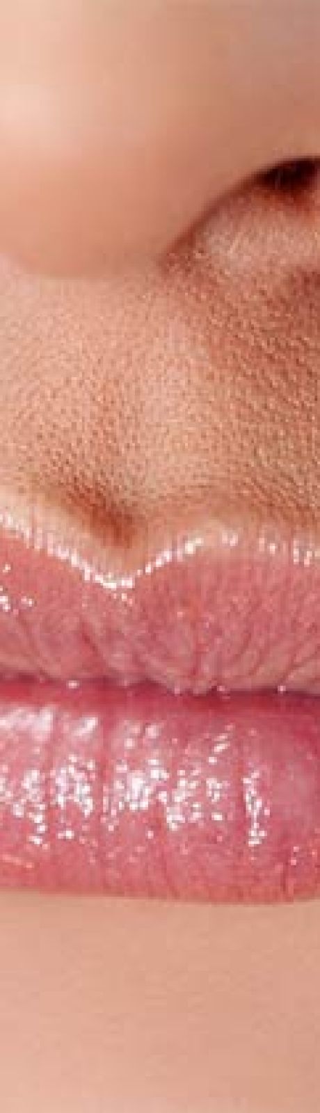 Lip lifts are one of our specialties here at Contour Dermatology.