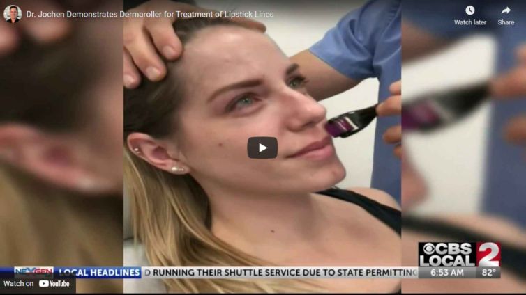 Dr. Jochen Demonstrates Dermaroller for Treatment of Lipstick Lines