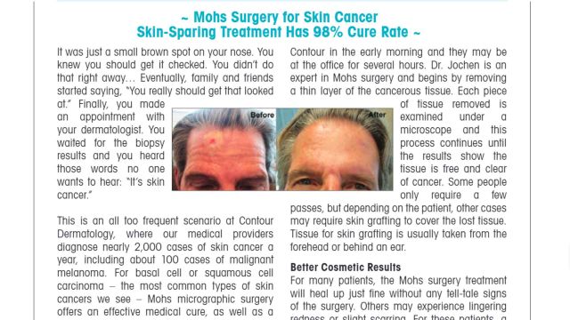 20151215-Mohs-Surgery-for-Skin-Cancer