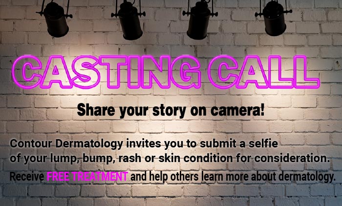 If you are interested in being on camera, please send us a selfie and a photo of any lumps, bumps, or skin conditions that are crusting or oozing or bleeding that concern you.