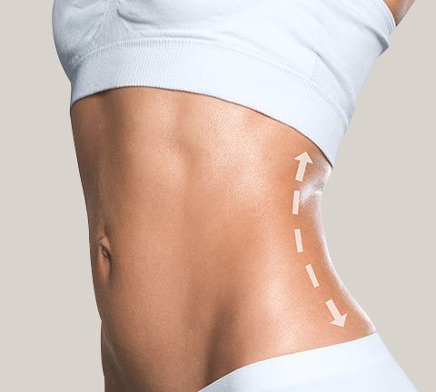 Liposuction removes fat cells permanently. With weight gain, new fat will generally not return to treated areas.
