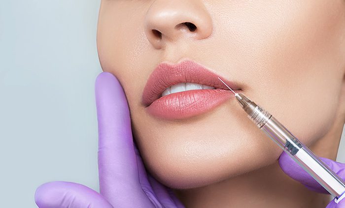 Kiss your other lip fillers goodbye with Restylane Kysse!