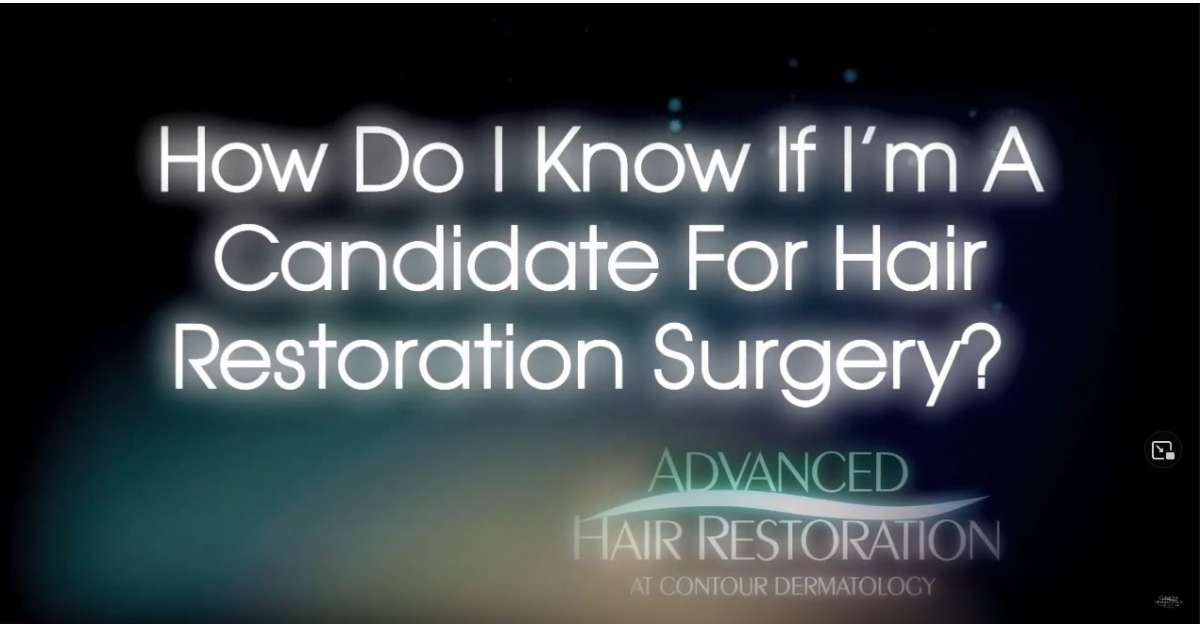 Hair Transplants, Hair Restoration | Restore Your Hairline