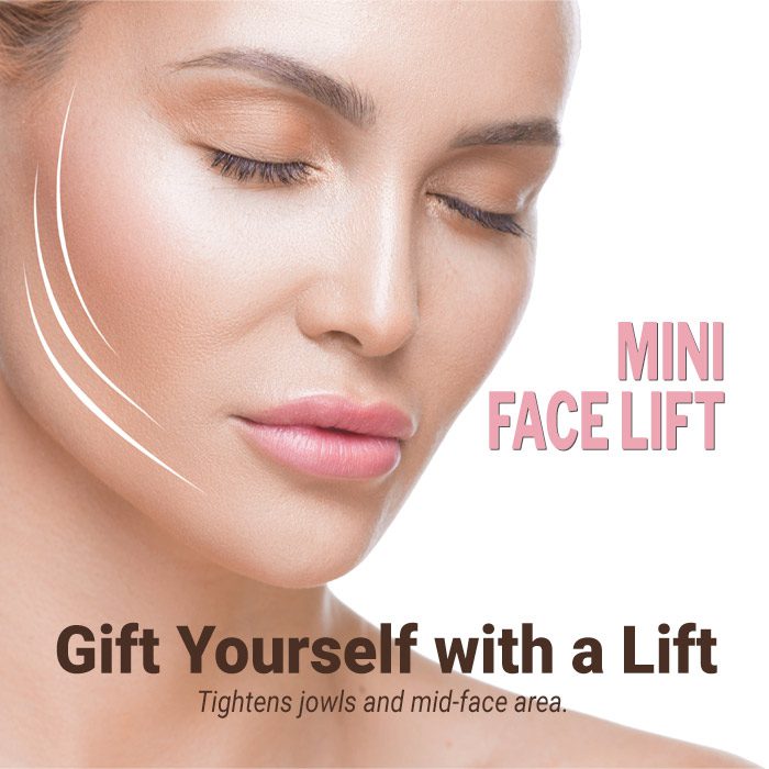 A mini facelift pulls back sagging skin and underlying muscle tissue in the lower one-third of the face. The results are long lasting with minimal scarring.