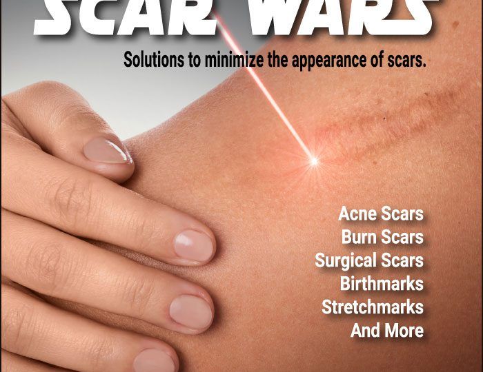 There are many types of scars and we have many cosmetic solutions to help improve their appearance which may improve your spirits. Read more