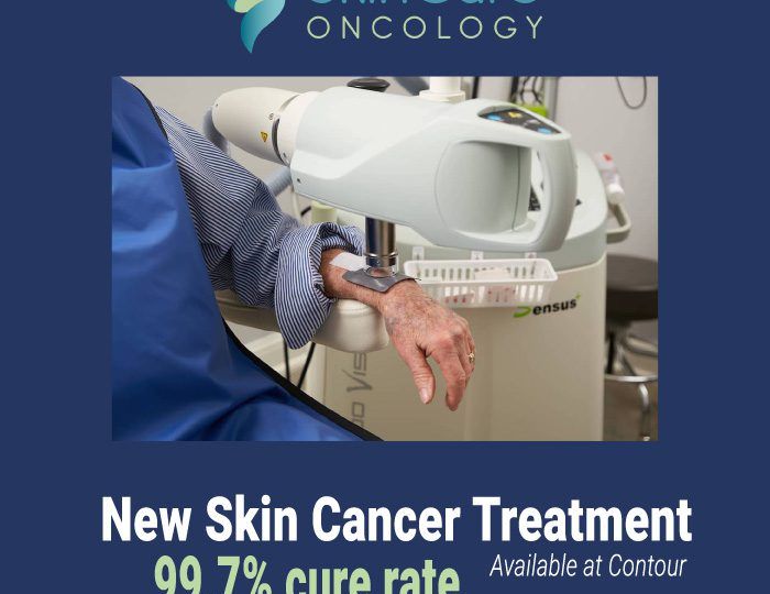 You now have more treatment options for skin cancer removal at Contour Dermatology. Learn more about our new device from SkinCure Oncology.
