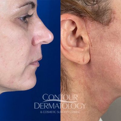 Miniface female age 54