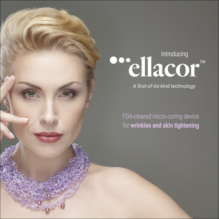 It’s called Ellacor, and it is an FDA-cleared micro-coring treatment™ featuring hollow needles. Yes, note the word “micro.” The hollow part of the needle removes a tiny portion of the skin a “micro-core,” and this is what produces the wound-healing result that will plump up your skin and provide visible wrinkle reduction.