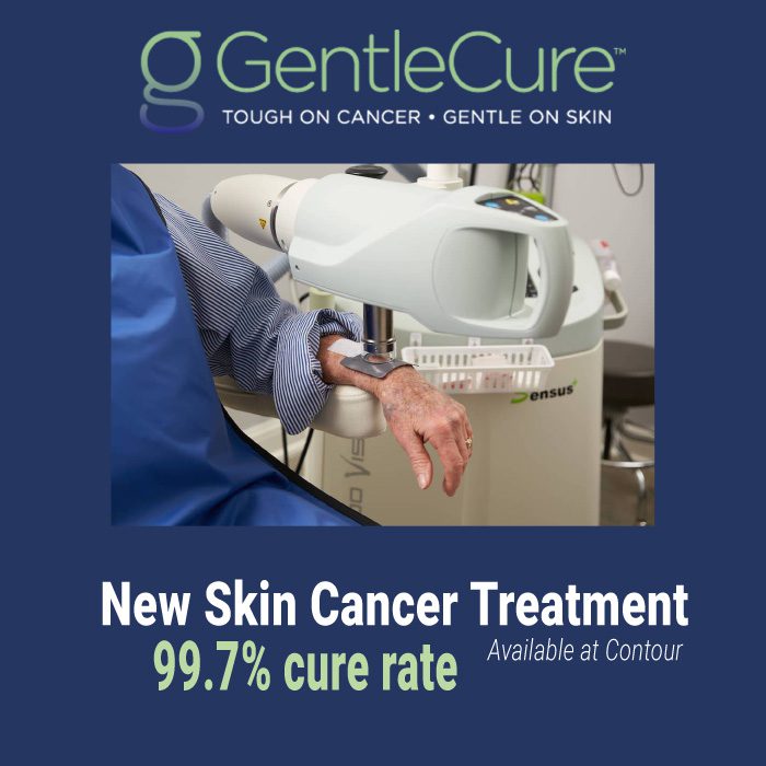 You now have more treatment options for skin cancer removal at Contour Dermatology. Learn more about our device from GentleCure Oncology.