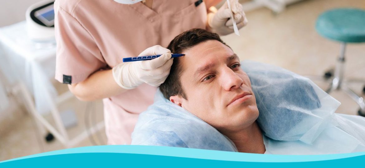 How Does Hair Transplantation Work for Restoring Hair Loss?