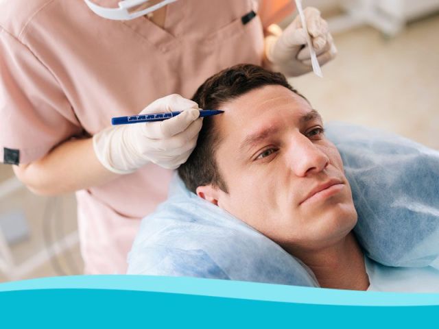 How Does Hair Transplantation Work for Restoring Hair Loss?