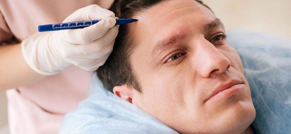 Man lying back as a clinician performs an eyebrow procedure with a gloved hand and a precision tool near his brow.